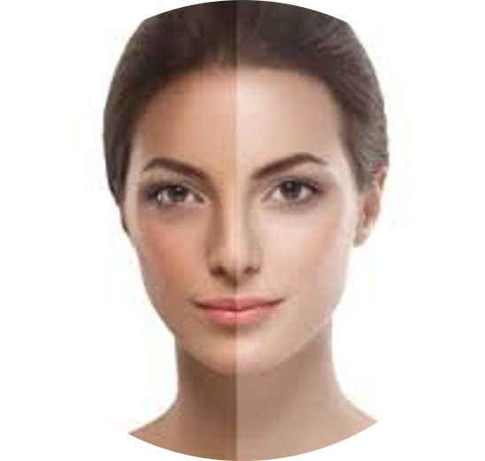 DCURE-clinic-hair_Fall_hair_baldness_treatment_skin_acne_treatment_skin_tone_best clinic_tirunelveli_PRP_body_Hydration_skin_peel_skin_glow_ueven_tone_face_tigtening_open_pore_DCURE_face_peel