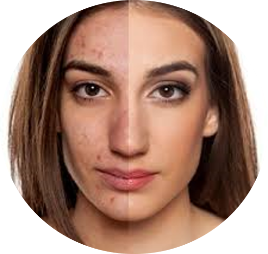 DCURE-clinic-hair_Fall_hair_regrowth_hair_baldness_treatment_skin_acne_treatment_skin_tone_best clinic_tirunelveli_PRP_DCURE_hair_Regrowth